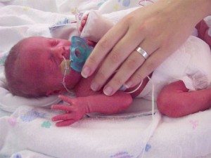 My Daughter in the NICU