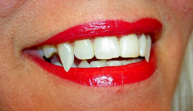 Teeth Courtesy the morguefile.com 