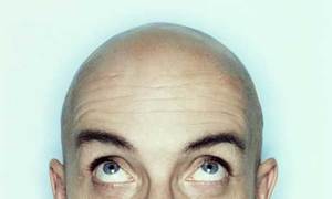 Bald460x276